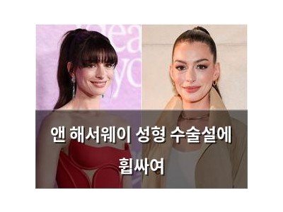 앤 해서웨이 성형 수술설에 휩싸여