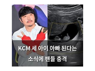 KCM 세 아이 아빠 된다는 소식에 팬들 충격