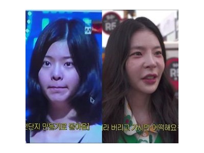 장재인 성형 의혹에 분노하며 직접 반박